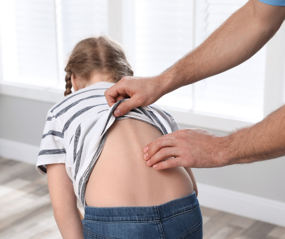 Qué es la Hiperlordosis y Cómo se Trabaja en Fisioterapia Infantil