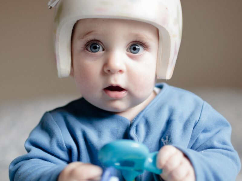 Relación entre tortícolis, plagiocefalia y desarrollo motor en peques